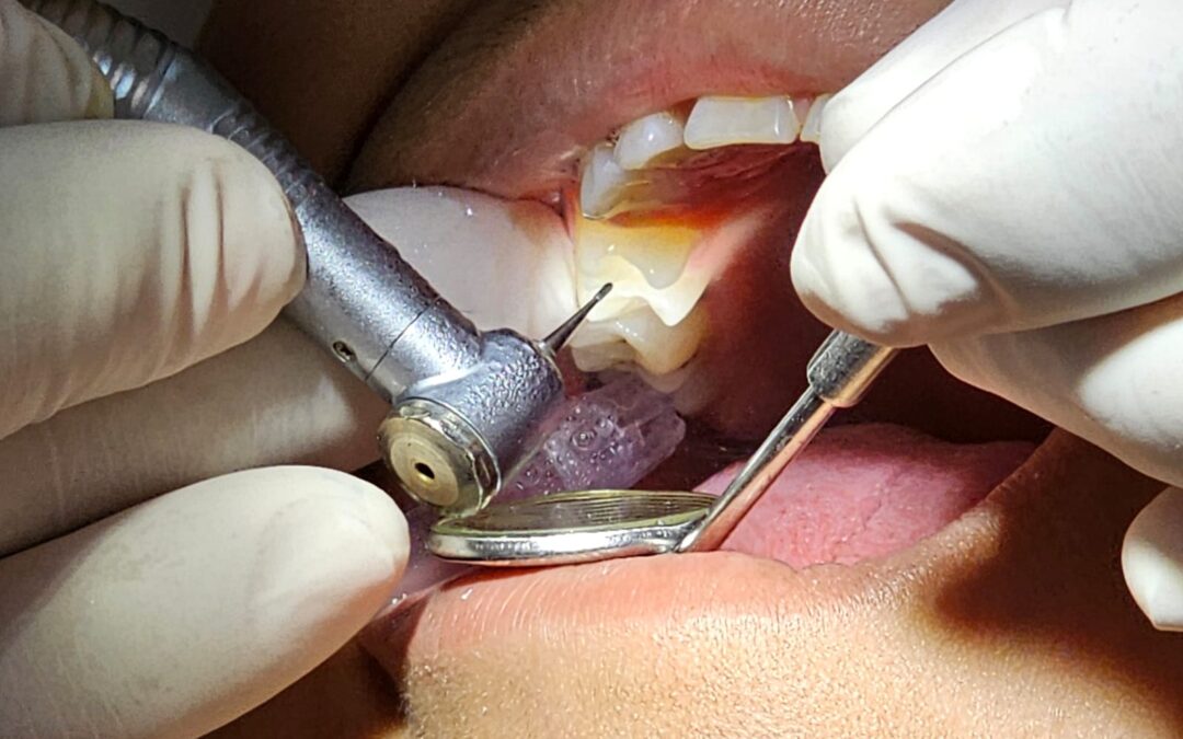 PREPARA IMSS COLIMA TERCER FERIA DE SALUD BUCAL