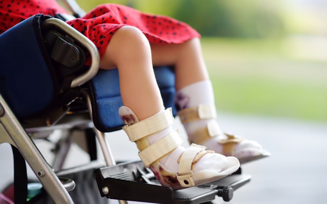 CONTROL PRENATAL ES FUNDAMENTAL PARA PREVENIR PARÁLISIS CEREBRAL: SALUD