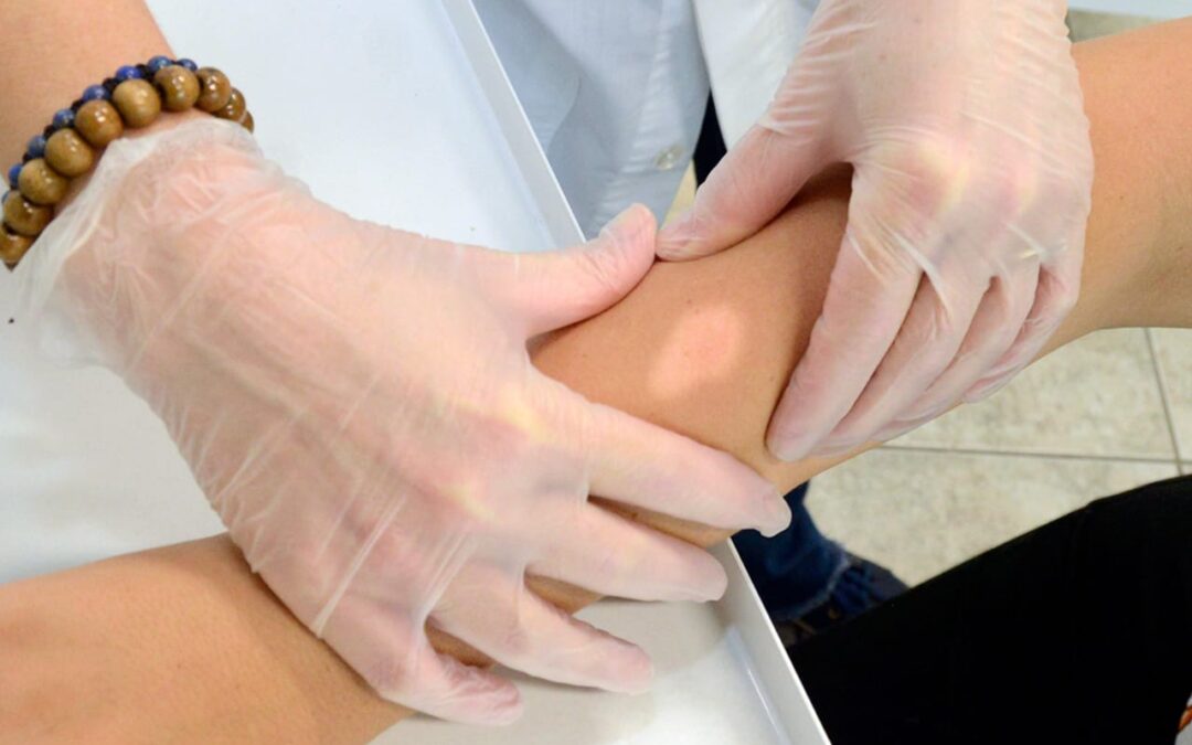 ES CURABLE LA LEPRA CON TRATAMIENTO COMPLETO, EN COLIMA SE BRINDA ATENCIÓN A ESTA ENFERMEDAD