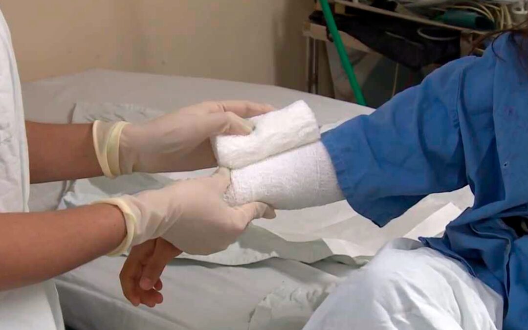 AL AÑO IMSS-BIENESTAR COLIMA ATIENDE A 4 O 5 MENORES POR QUEMADURAS